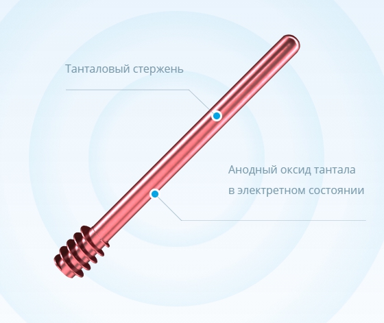 Современное лечения артроза - Имплэсо